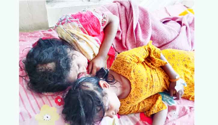 দুর্গাপুরে ৪র্থ শ্রেণির শিক্ষার্থীকে কুপিয়ে জখম,থানায় অভিযোগ