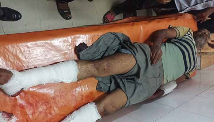 সাঁথিয়ায় আ.লীগ নেতাকে হাতুড়ি দিয়ে পিটিয়ে আহত করেছে প্রতিপক্ষরা সাঁথিয়ায় আ.লীগ নেতাকে হাতুড়ি দিয়ে পিটিয়ে আহত করেছে প্রতিপক্ষরা