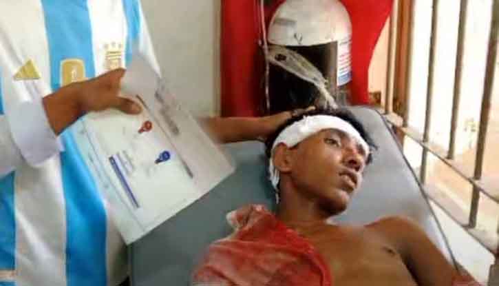 ধর্মপাশায় ছাত্র ও নির্মাণ শ্রমিকদের মধ্যে ধাওয়া-পাল্টা ধাওয়ার ঘটনায় আহত ৪ ধর্মপাশায় ছাত্র ও নির্মাণ শ্রমিকদের মধ্যে ধাওয়া-পাল্টা ধাওয়ার ঘটনায় আহত ৪