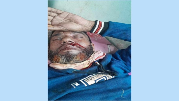 মানিকগঞ্জ সিঙ্গাইরে মমতাজের কর্মীর হাতে বিজয়ী টুলু’র কর্মী নিহত মানিকগঞ্জ সিঙ্গাইরে মমতাজের কর্মীর হাতে বিজয়ী টুলু’র কর্মী নিহত