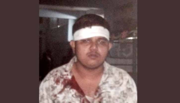 মোহনগঞ্জে অটোরিকশার যাত্রীবেশে ছিনতাই, কলেজ শিক্ষার্থী আহত